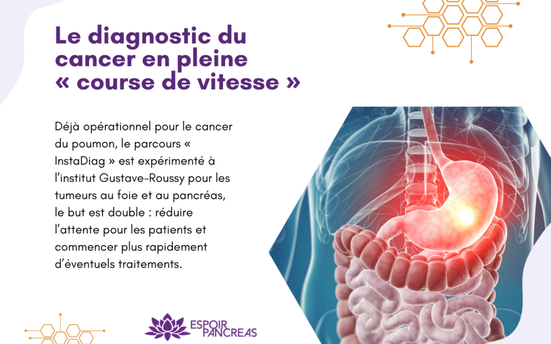 Le diagnostic du cancer en pleine « course de vitesse »