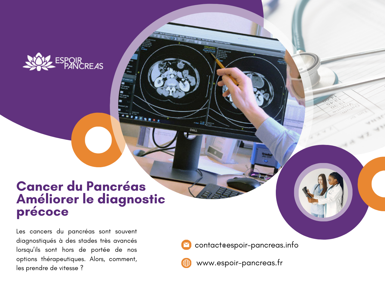 Cancer du pancréas améliorer le diagnostic précoce Espoir Pancréas
