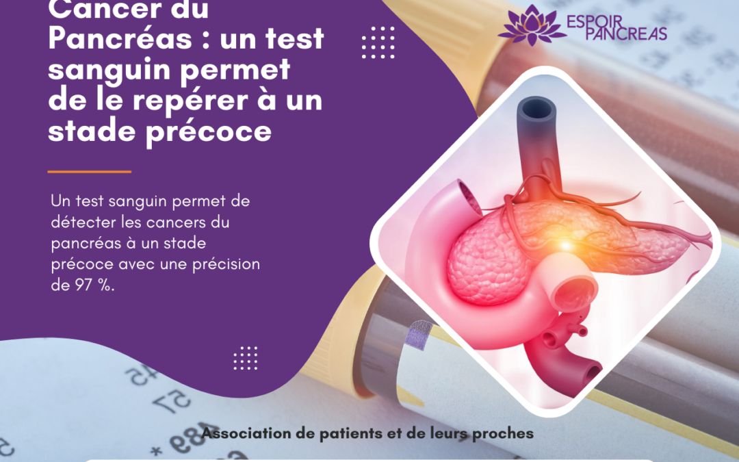 Cancer du pancréas : un test sanguin permet de le repérer à un stade précoce